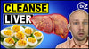 What To Eat To Reduce Fatty Liver - Must See!