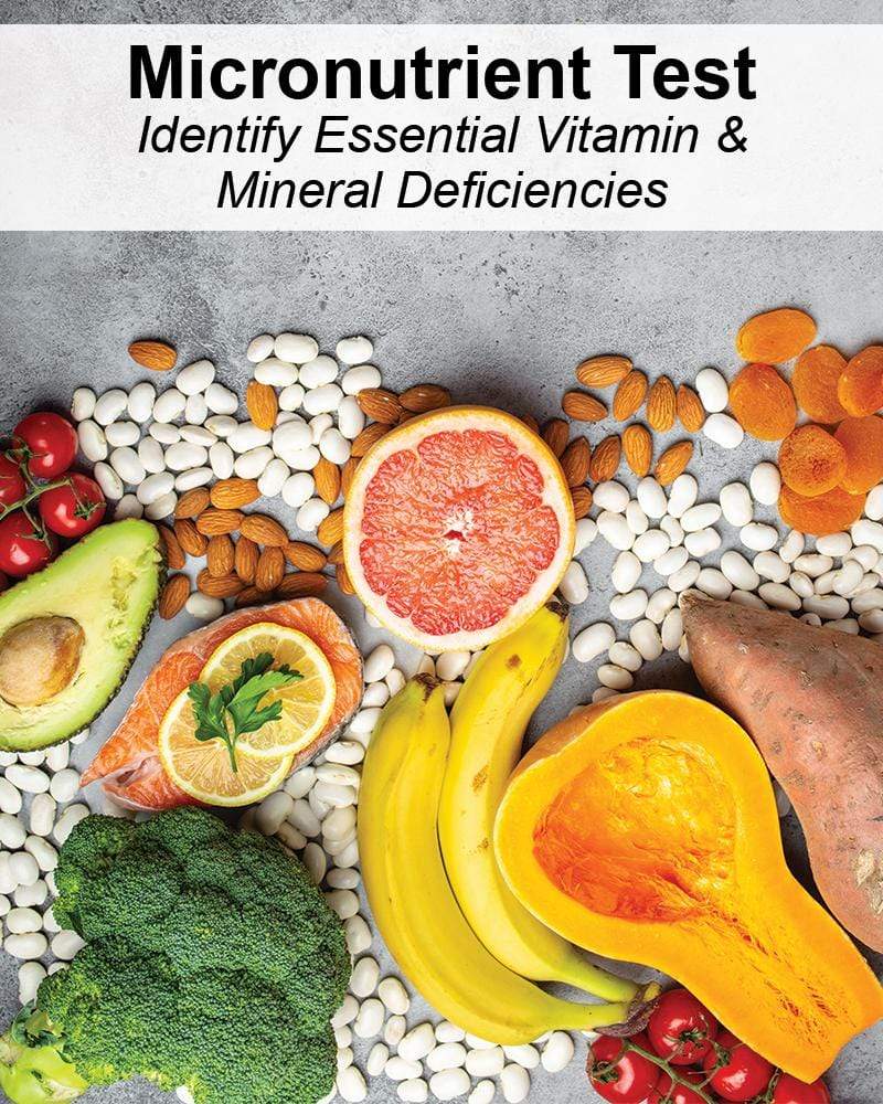 Micronutrient Test - NuVision Health Center